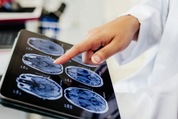 video premiera medicala la spitalul bagdasar arseni din bucuresti operatie pe creier cu pacientul treaz a fost foarte curajos 691c22288e66a