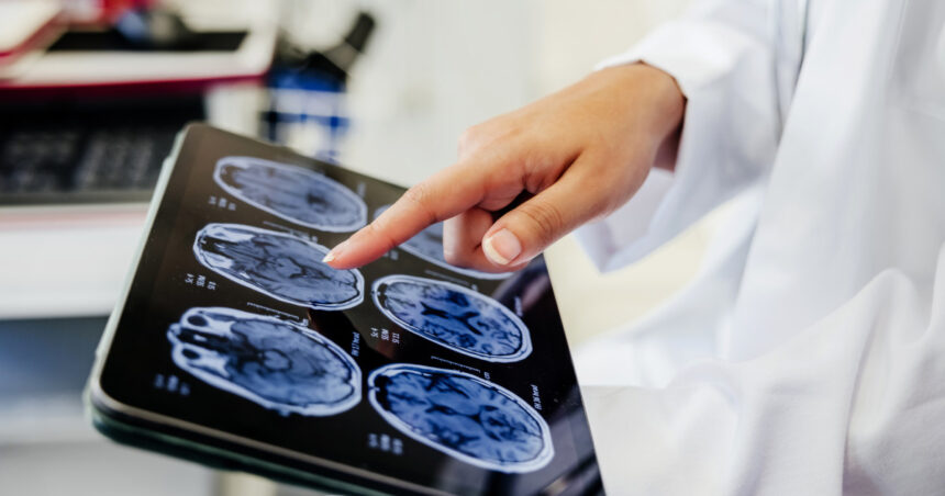 video premiera medicala la spitalul bagdasar arseni din bucuresti operatie pe creier cu pacientul treaz a fost foarte curajos 691c22288e66a