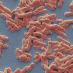 caz de lepra in romania de cate feluri este boala cum se manifesta si cum se trateaza explicatiile unui medic 693bf39cd0b20