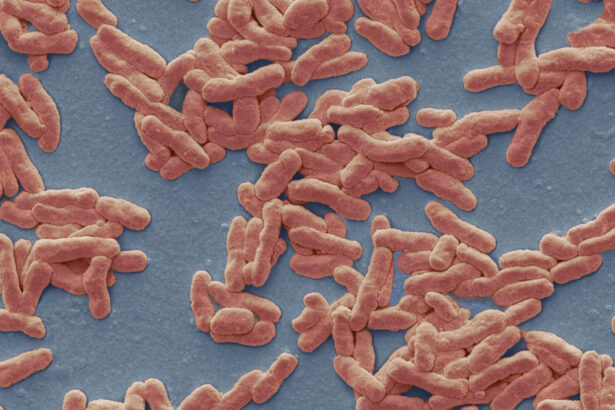 caz de lepra in romania de cate feluri este boala cum se manifesta si cum se trateaza explicatiile unui medic 693bf39cd0b20