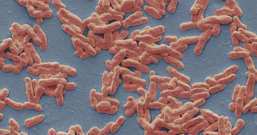 caz de lepra in romania de cate feluri este boala cum se manifesta si cum se trateaza explicatiile unui medic 693bf39cd0b20