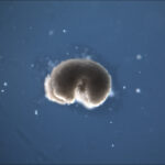 ce este a treia stare a vietii si ce se intampla cu celulele dupa moartea organismului 694af0f9a2050