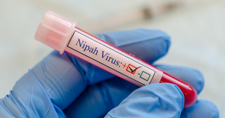 ce este virusul nipah care a declansat controale de securitate pe aeroporturile din asia ce riscuri exista pentru romania 6979f80ce378d