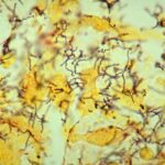 cea mai veche dovada pentru originea sifilisului descoperita pe un schelet vechi de 5 500 de ani 697641527fb7b