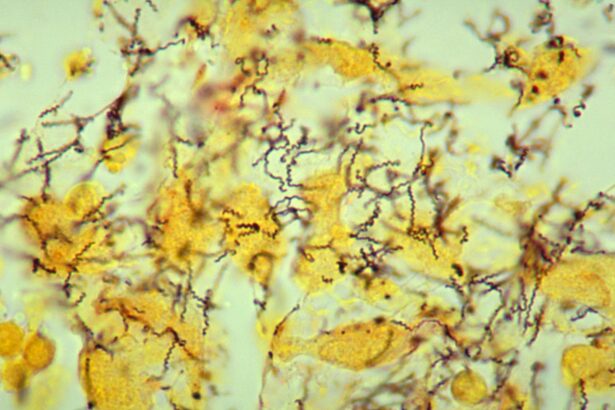 cea mai veche dovada pentru originea sifilisului descoperita pe un schelet vechi de 5 500 de ani 697641527fb7b