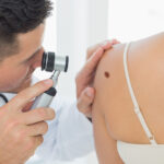 cum identifici alunitele cu risc de cancer dermatologii explica semnele importante care necesita evaluare urgenta 697480d4942e9
