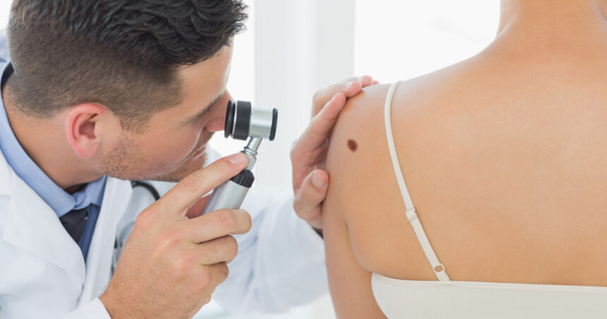 cum identifici alunitele cu risc de cancer dermatologii explica semnele importante care necesita evaluare urgenta 697480d4942e9