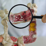 metoda prin care specialistii vor sa descopere de ce tot mai multi tineri sunt diagnosticati cu cancer o resursa unica 69632fa609054