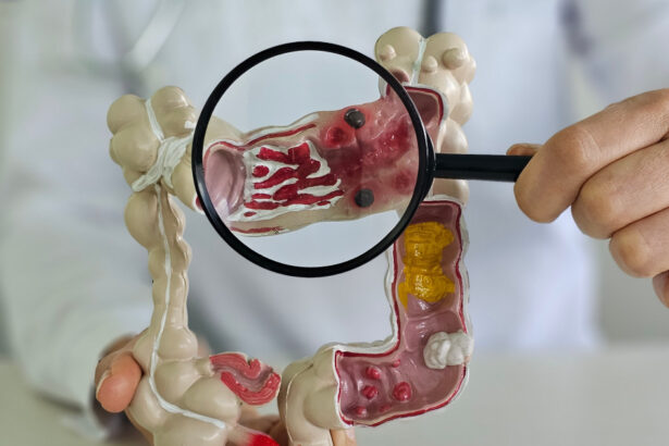 metoda prin care specialistii vor sa descopere de ce tot mai multi tineri sunt diagnosticati cu cancer o resursa unica 69632fa609054