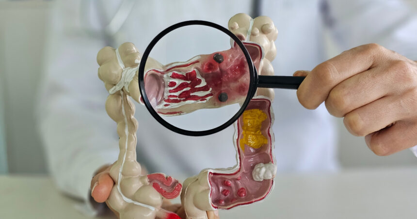 metoda prin care specialistii vor sa descopere de ce tot mai multi tineri sunt diagnosticati cu cancer o resursa unica 69632fa609054