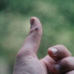 test de cultura generala care este cea mai buna metoda de a scoate o aschie 6980cd5c09768