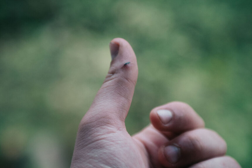 test de cultura generala care este cea mai buna metoda de a scoate o aschie 6980cd5c09768