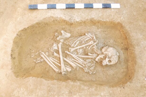 un studiu adn a dezvaluit boala rara de care suferea o adolescenta care traia in italia acum 12 000 de ani 697fc9131934e