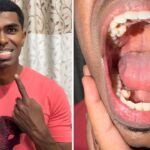 barbatul cu cei mai multi dinti din lume isi etaleaza zambetul record am cu 10 mai multi decat o persoana obisnuita video 69b91591f1a32