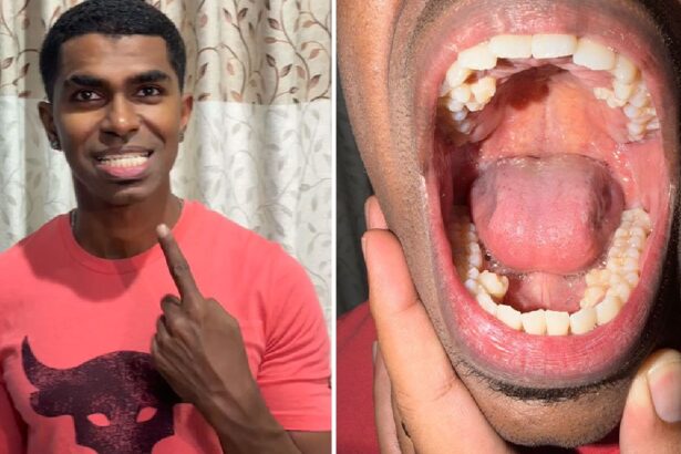 barbatul cu cei mai multi dinti din lume isi etaleaza zambetul record am cu 10 mai multi decat o persoana obisnuita video 69b91591f1a32