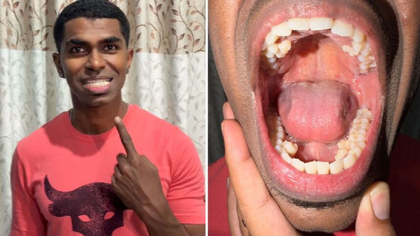 barbatul cu cei mai multi dinti din lume isi etaleaza zambetul record am cu 10 mai multi decat o persoana obisnuita video 69b91591f1a32