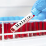 trei cazuri suspecte de malarie la copii dupa o calatorie in africa anuntul ministrului sanatatii 69c1577bad2f9