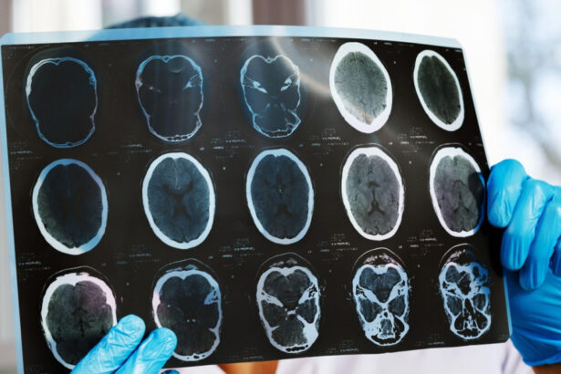 asociatiile de pacienti cer interventia ministerului sanatatii si cnas dupa scaderea cu 47 a investigatiilor de monitorizare 69cf91a2c08cc