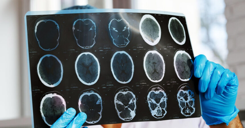 asociatiile de pacienti cer interventia ministerului sanatatii si cnas dupa scaderea cu 47 a investigatiilor de monitorizare 69cf91a2c08cc