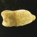 bacteria scarlatinei a fost gasita intr o mumie precolumbiana de ce conteaza descoperirea 69e78c245ff5d