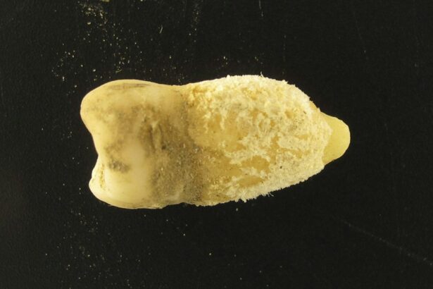 bacteria scarlatinei a fost gasita intr o mumie precolumbiana de ce conteaza descoperirea 69e78c245ff5d