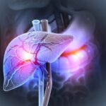 boala ficatului gras in crestere 18 miliarde de persoane ar putea fi afectate pana in 2050 69e62cbe20c6c