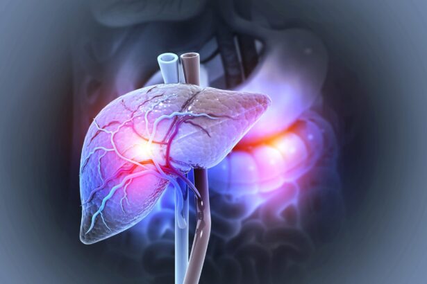 boala ficatului gras in crestere 18 miliarde de persoane ar putea fi afectate pana in 2050 69e62cbe20c6c