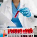 premiera o tehnica noua a fost utilizata cu succes pentru tratarea unei afectiuni sangvine de care sufera multi oameni 69ddc1753392e