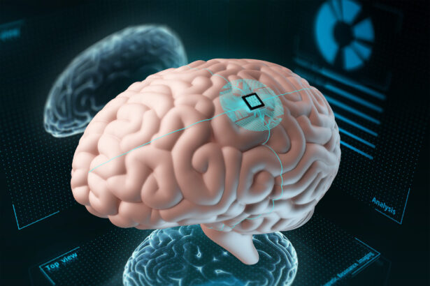 un implant mai mic decat un bob de sare iti poate citi creierul in timp real 69cd7464d6600