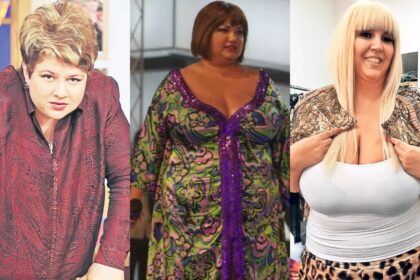 vedetele din romania care si au taiat stomacul imagini inainte si dupa operatia de slabit 69e9eeefdd4bd