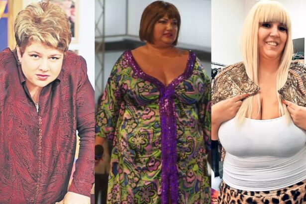 vedetele din romania care si au taiat stomacul imagini inainte si dupa operatia de slabit 69e9eeefdd4bd