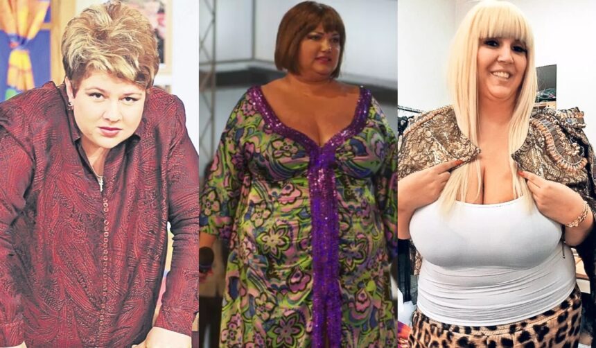 vedetele din romania care si au taiat stomacul imagini inainte si dupa operatia de slabit 69e9eeefdd4bd