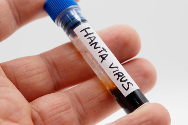 ucraina inregistreaza zeci de cazuri de hantavirus in fiecare an sustine centrul de sanatate publica ucrainean 6a016e63cdd05