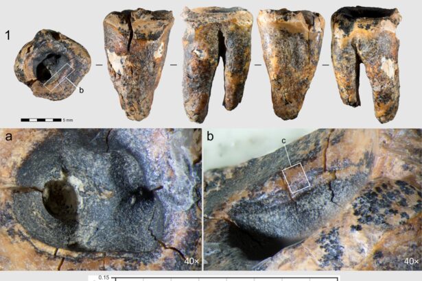 unde practicau neanderthalienii stomatologia acum 60 000 de ani 6a0c615433469