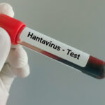 video suspiciune de hantavirus la arad autoritatile au declansat o ancheta epidemiologica ce spun medicii despre tulpina virusului 6a075315514bc