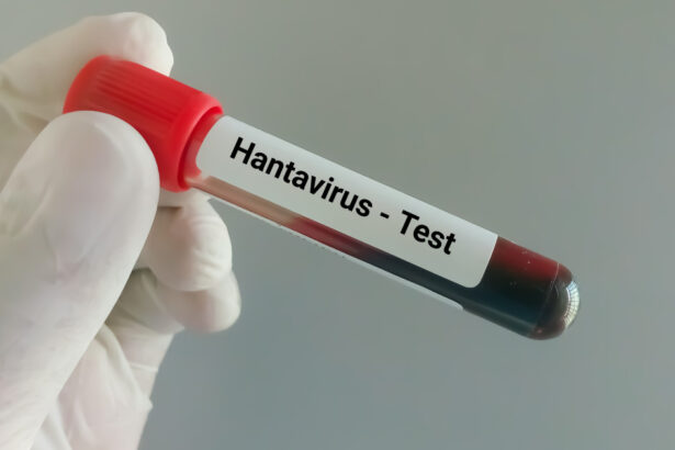 video suspiciune de hantavirus la arad autoritatile au declansat o ancheta epidemiologica ce spun medicii despre tulpina virusului 6a075315514bc