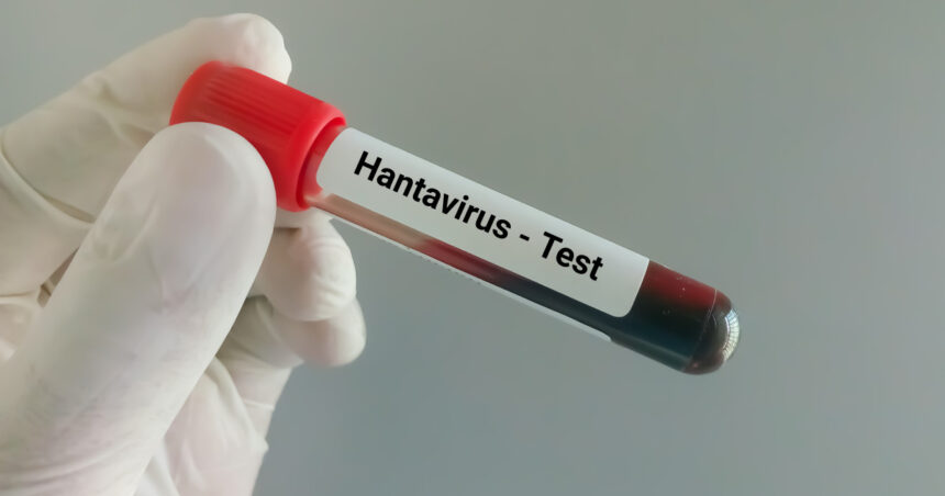 video suspiciune de hantavirus la arad autoritatile au declansat o ancheta epidemiologica ce spun medicii despre tulpina virusului 6a075315514bc