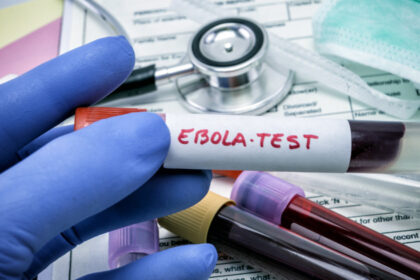 virusul ebola poate ramane ascuns in organism luni sau ani cum poate reaparea infectia studiu 6a36711fa2757