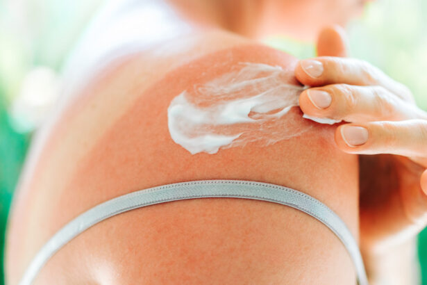 ce face o crema cu spf sa fie cu adevarat eficienta dermatologii explica cum poate contribui la reducerea riscului de cancer de piele 6a51c55be88e2