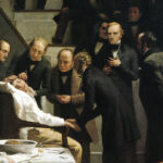 ziua in care chirurgia a invins durerea cum a schimbat o operatie de cateva minute istoria medicinei 6a5e24ce5f151