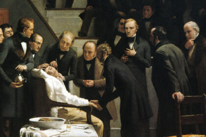ziua in care chirurgia a invins durerea cum a schimbat o operatie de cateva minute istoria medicinei 6a5e24ce5f151