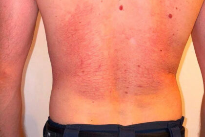 foto sindicatul europol reclama efectele purtarii vestei antiinjunghiere politia capitalei rolul ei nu e de a o utiliza dupa ce pericolul 6a8d7413c82ea