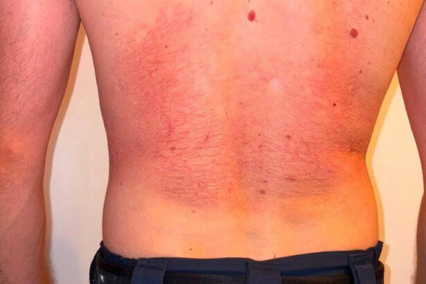 foto sindicatul europol reclama efectele purtarii vestei antiinjunghiere politia capitalei rolul ei nu e de a o utiliza dupa ce pericolul 6a8d7413c82ea