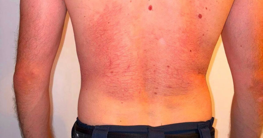foto sindicatul europol reclama efectele purtarii vestei antiinjunghiere politia capitalei rolul ei nu e de a o utiliza dupa ce pericolul 6a8d7413c82ea