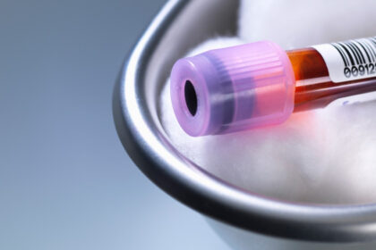 premiera medicala in sua un robot va putea recolta singur sange de la pacienti cum functioneaza noua tehnologie 6a8abbfa860aa