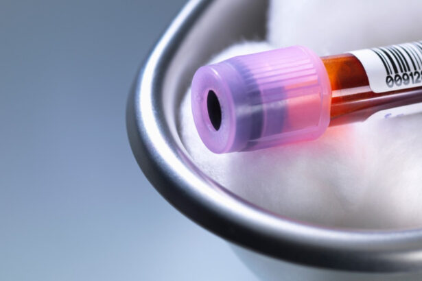 premiera medicala in sua un robot va putea recolta singur sange de la pacienti cum functioneaza noua tehnologie 6a8abbfa860aa