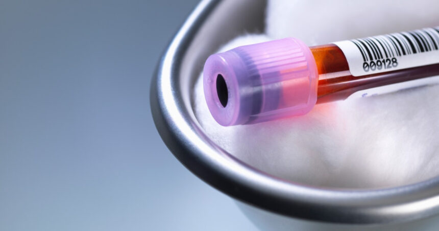 premiera medicala in sua un robot va putea recolta singur sange de la pacienti cum functioneaza noua tehnologie 6a8abbfa860aa