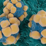 un ingredient activ din viagra ar putea limita raspandirea cancerului studiu 6a7188d0e0381