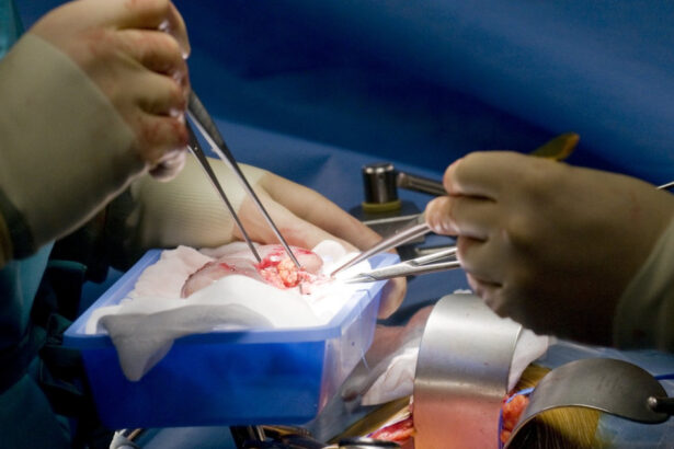 record medical un rinichi de porc transplantat a functionat in corpul unui pacient din sua timp de 271 de zile 6a9a9f8e6eeba