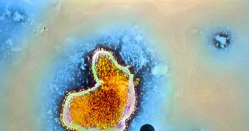 mexic amiba mancatoare de creier a fost detectata in yucatan sase lacuri au fost inchise autoritatile in alerta 6ad1408a038a6